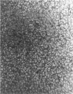 High-resolution Imaging of the Sun: The Stratoscope I images revealed the properties of convection cells in the solar photosphere. The scale bar in the upper right is an angular size of 1 arcsecond at the Sun's surface.For more information about this image see Schwarzschild, M. 1959, ApJ, 130, 345.